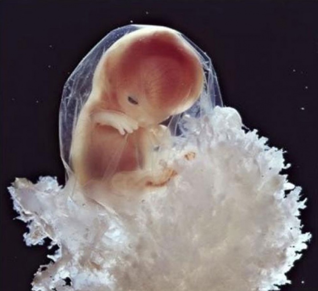 bebe