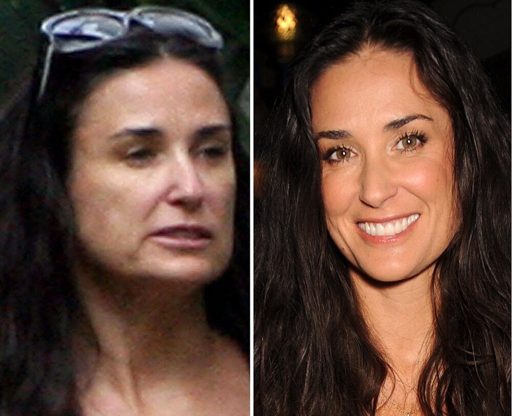 Operatiile estetice - moft sau necesitate? demi_moore_plastic_surgery-9667360
