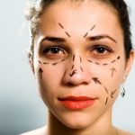 Top 5 cel mai des întâlnite operații estetice