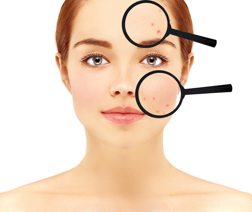 Top 5 greşeli de îngrijire a pielii