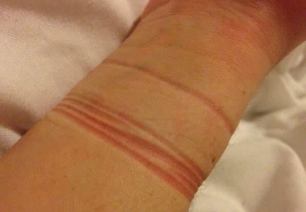 1-urme-elastic-de-par-9040537