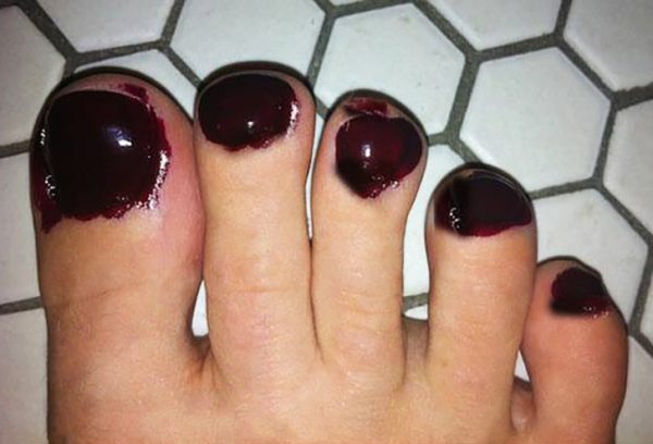 3-11-600x408-7763359