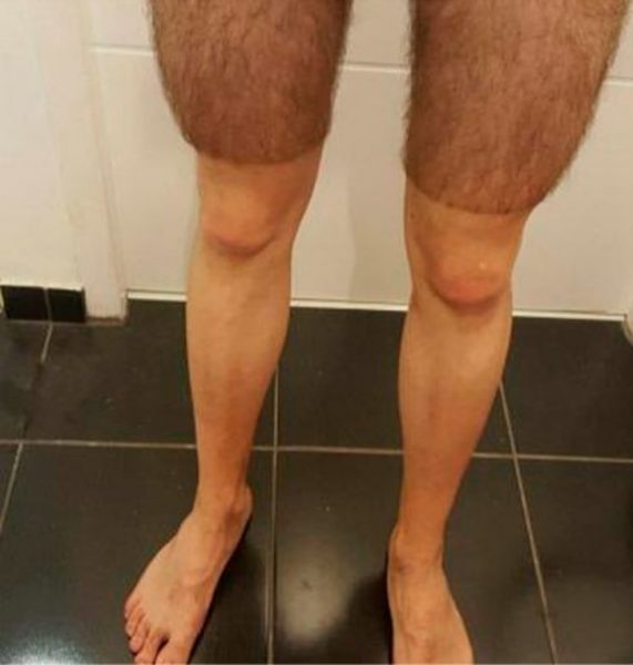 7-15-571x600-9045033