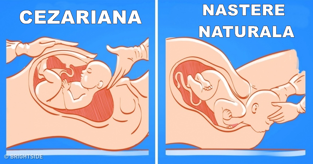 cum să pierzi grăsimea suplimentară în timpul sarcinii