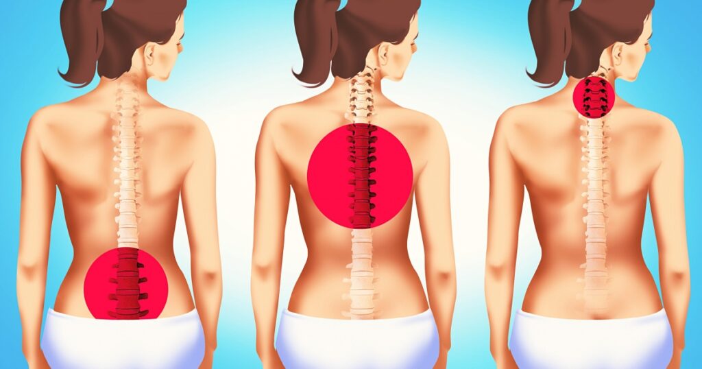 Remedii pentru durerile de spate – elimină disconfortul și sunt la îndemâna oricui!