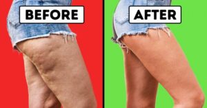 20 de minute de exerciții și vei obține picioare de model