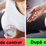 10 lucruri pe care NU trebuie să le FACI înainte să mergi la doctor