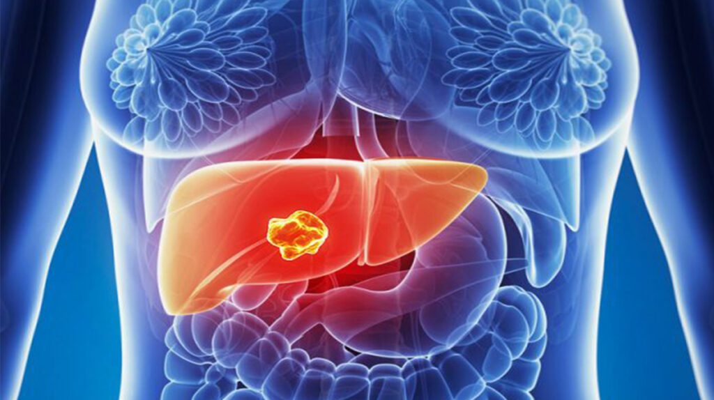 5 dintre alimentele care îți curăță ficatul