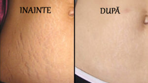 6 trucuri care te ajută să SCAPI de VERGETURI